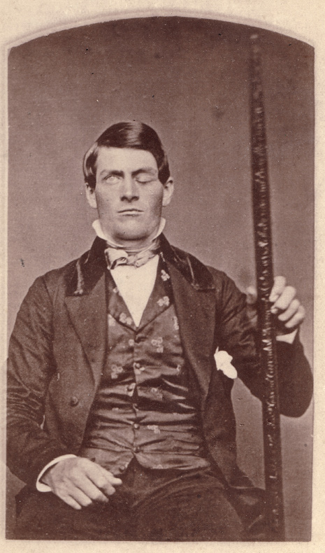 Phineas Gage często fotografował się z prętem, który przebił mu głowę. Źródło: Wikipedia